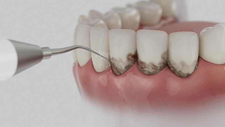 Reliable Dental contractor in Pleasant Hill, OH by Dentist Open Now